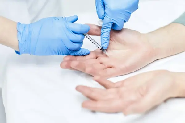 Hand Sweating Botox